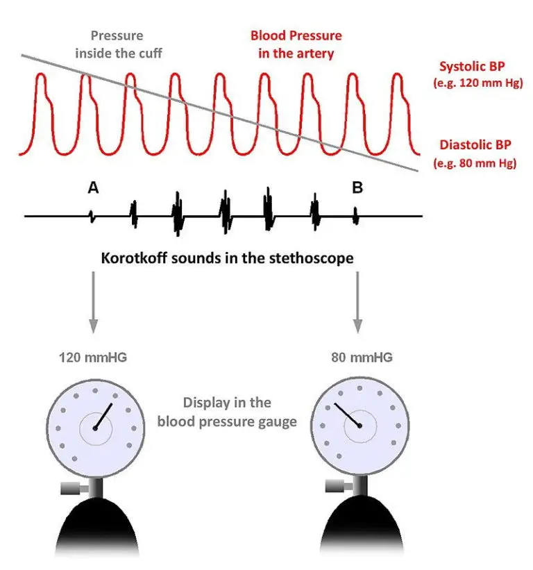 Why Is Blood Pressure Measured In Millimetres Of Mercury mmHg?