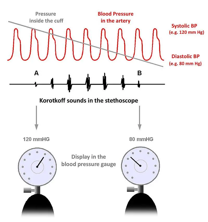 Kototkoff Sounds Blood Pressure